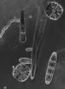 freshwater diatoms and desmids